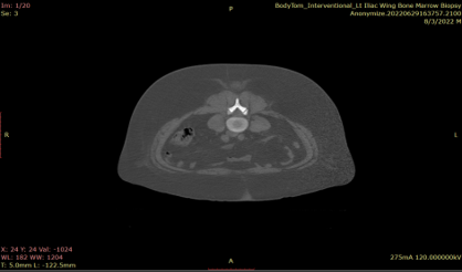 Step 2: Pre-Procedure Helical Scan