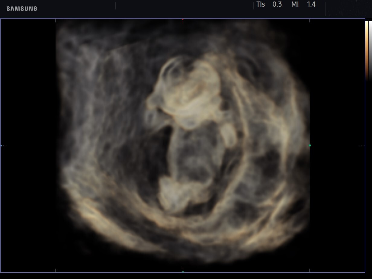 3_2. CrystalVue_2-1
