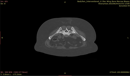 6 Post Procedure scan