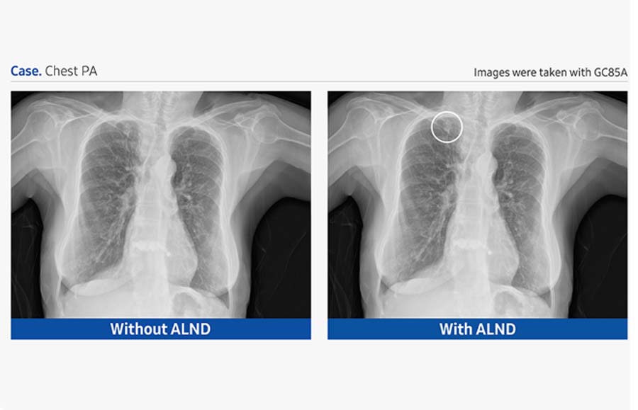 邦楽 X-RAY GR40CW Radiography Retrofit | Samsung Healthcare