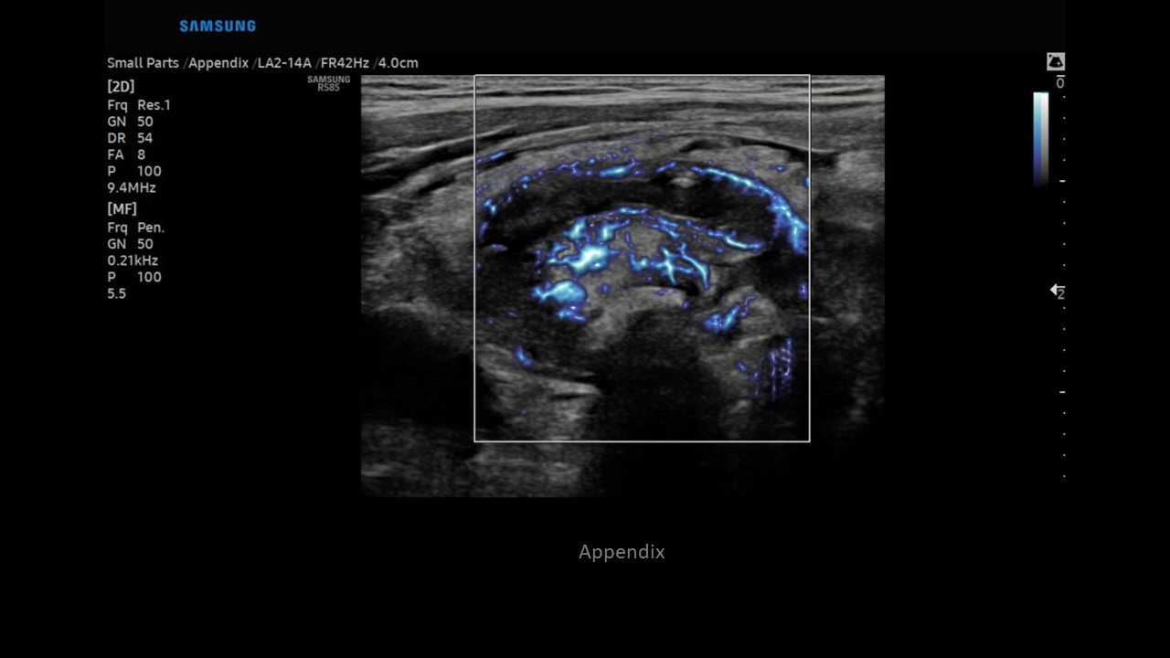 Appendix MVFlow