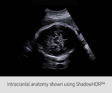 Intracranial-Antaomy_Grey