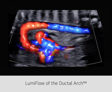 LumniFlow-of-the-Ductal-Arch_FINAL