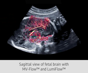 Sagittal-View_Hera_Grey
