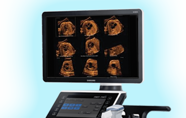 ultrasound-banner-WS80A