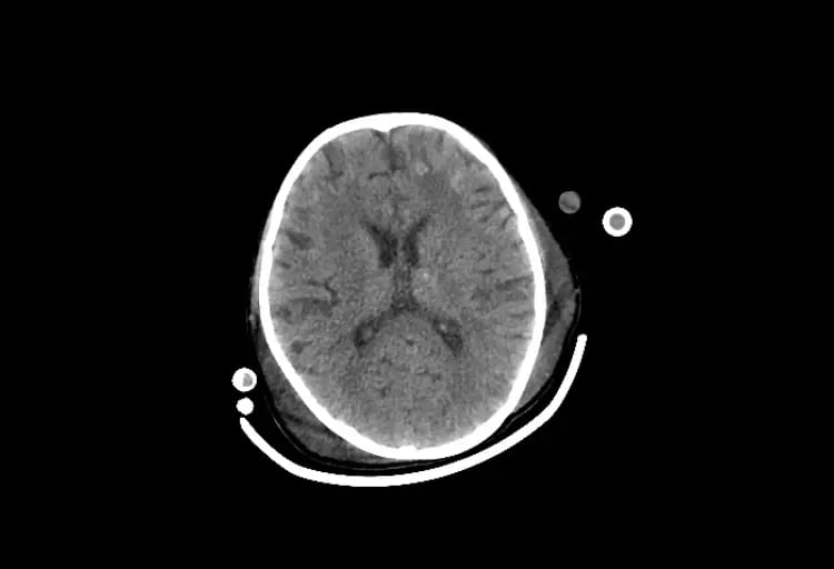 CereTom Pediatric A Axial Brain-1