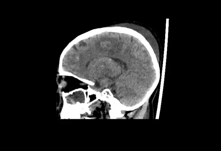 CereTom Pediatric A Sagittal Brain-1