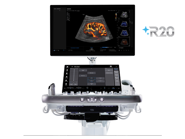 Ultrasound | General Imaging | R20 | Samsung Healthcare