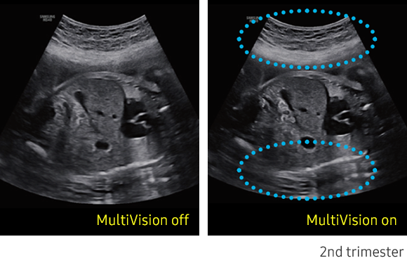 HS40_MultiVision On-Off