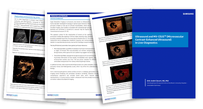 MV-CEUS-WP-inset