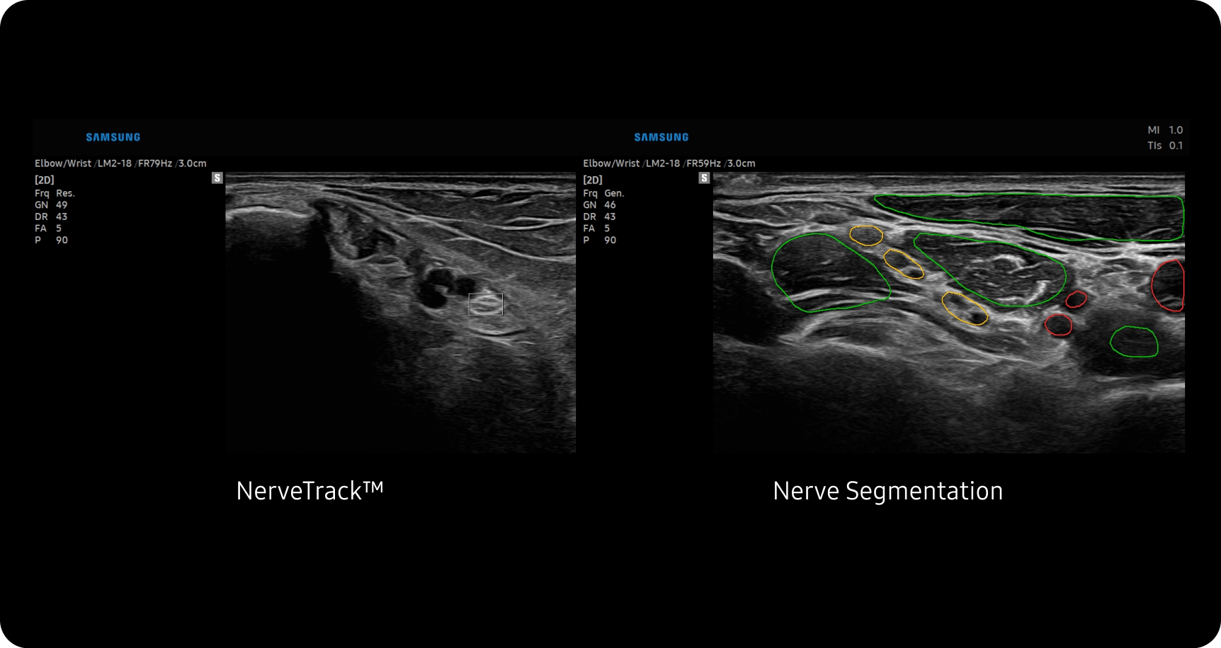 Nervetrack