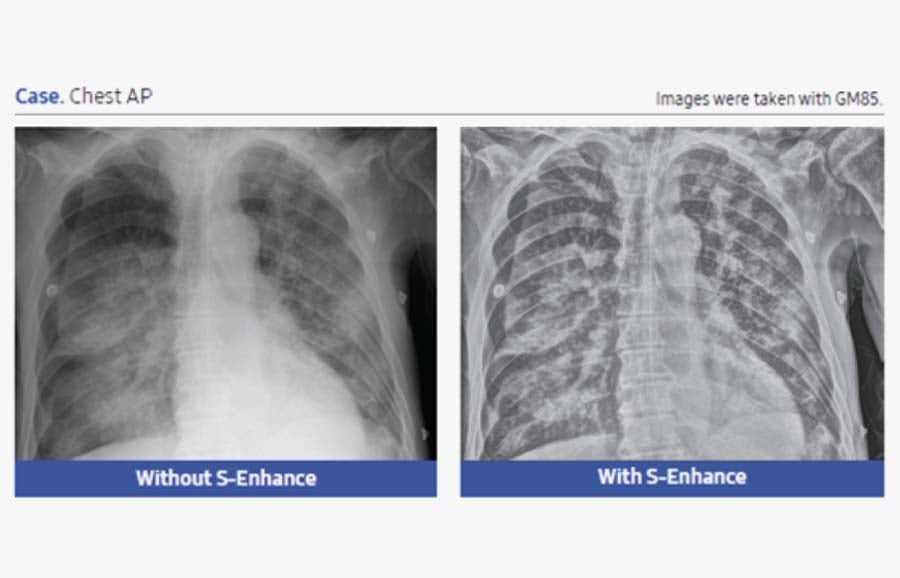 S-Enhance (2)