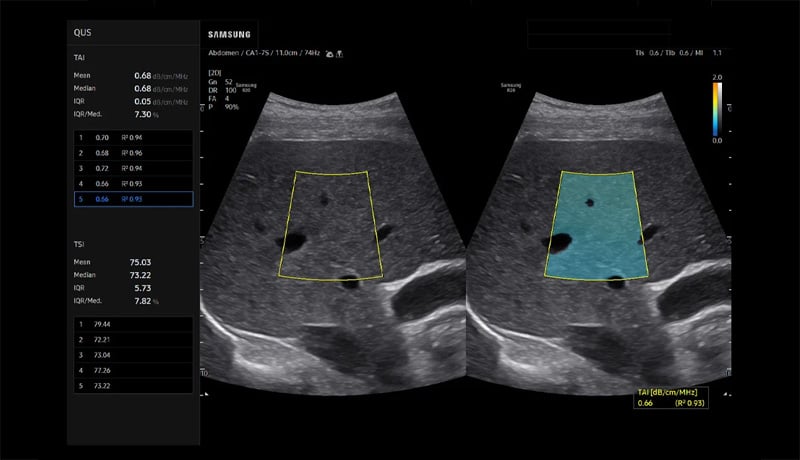 Samsung-R20-QUS-TAI-TSI-image