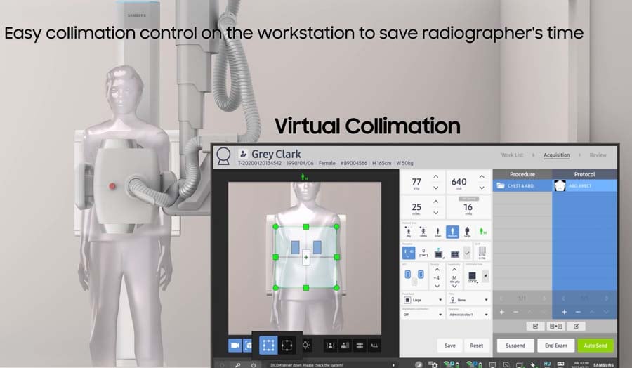 Virtual Collimation (1)
