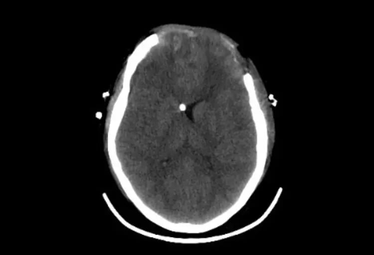 omnitom-elite-Adult Brain