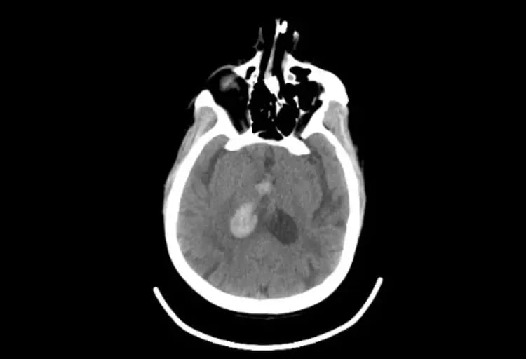 omnitom-elite-Adult Neuro
