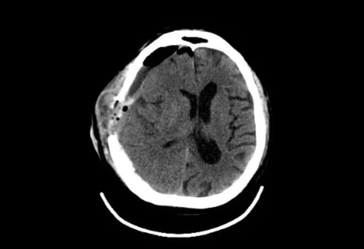 omnitom-elite-OmniTom Adult Brain 3