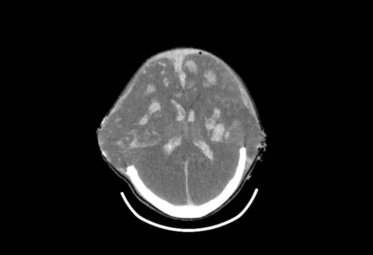omnitom-elite-Pediatric Brain-4