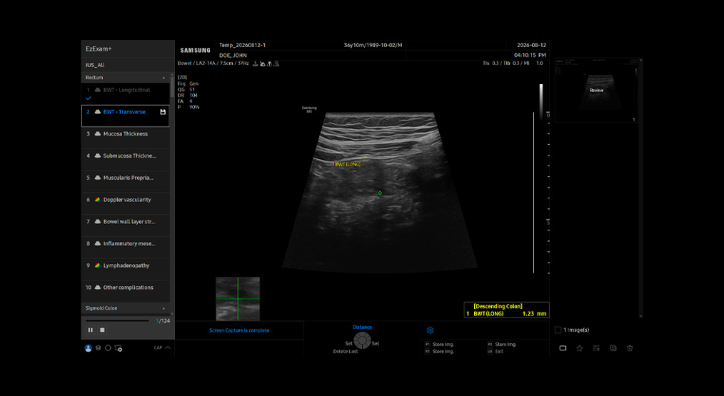 r20-card-bowel-report