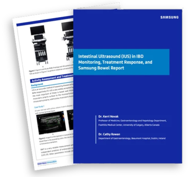 r20-intestinal-idb-wp