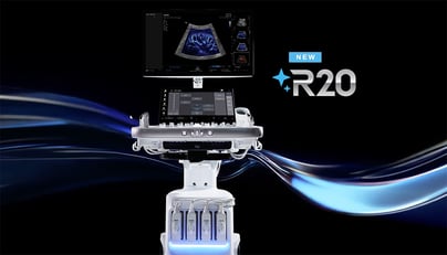 Samsung R20 Imaging Samsung to Introduce R20 Ultrasound System at RSNA 2025, Elevating ...