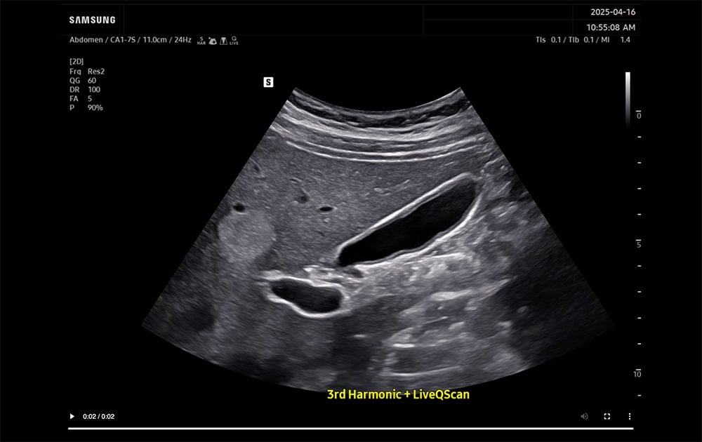 Ultrasound | General Imaging | R20 | Samsung Healthcare