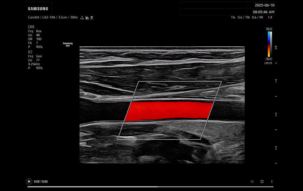 Ultrasound | General Imaging | R20 | Samsung Healthcare