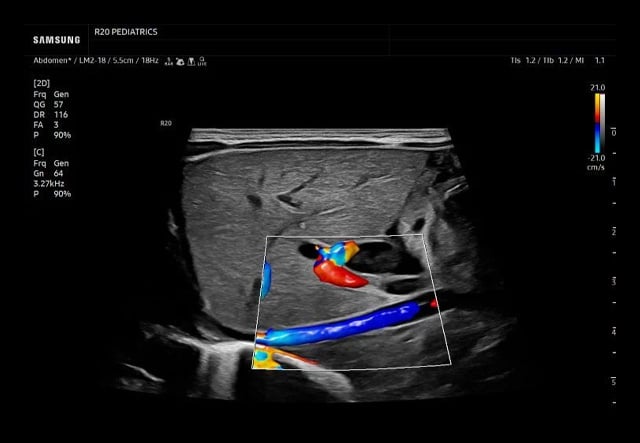 samsung-R20-Peds-abdo