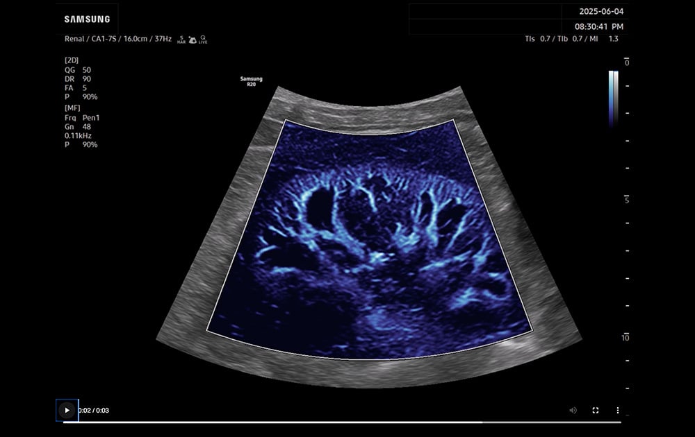 Ultrasound | General Imaging | R20 | Samsung Healthcare