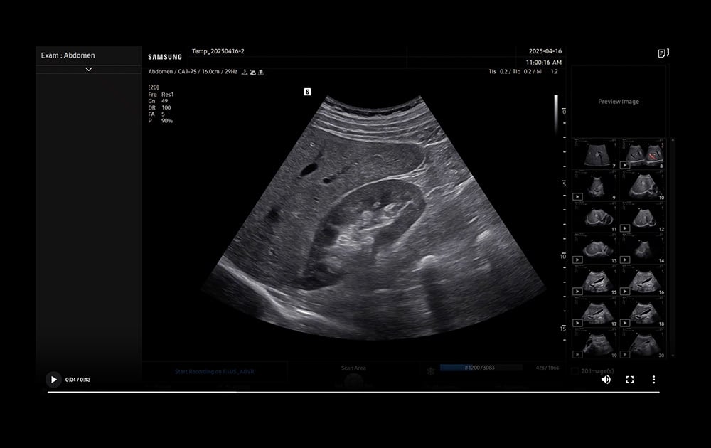 samsung-ai-assist-thumbnail