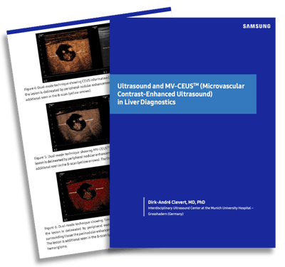 Samsung Ultrasound GI CEUS White Paper