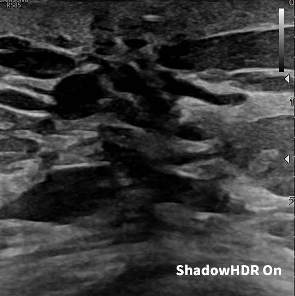 after-image