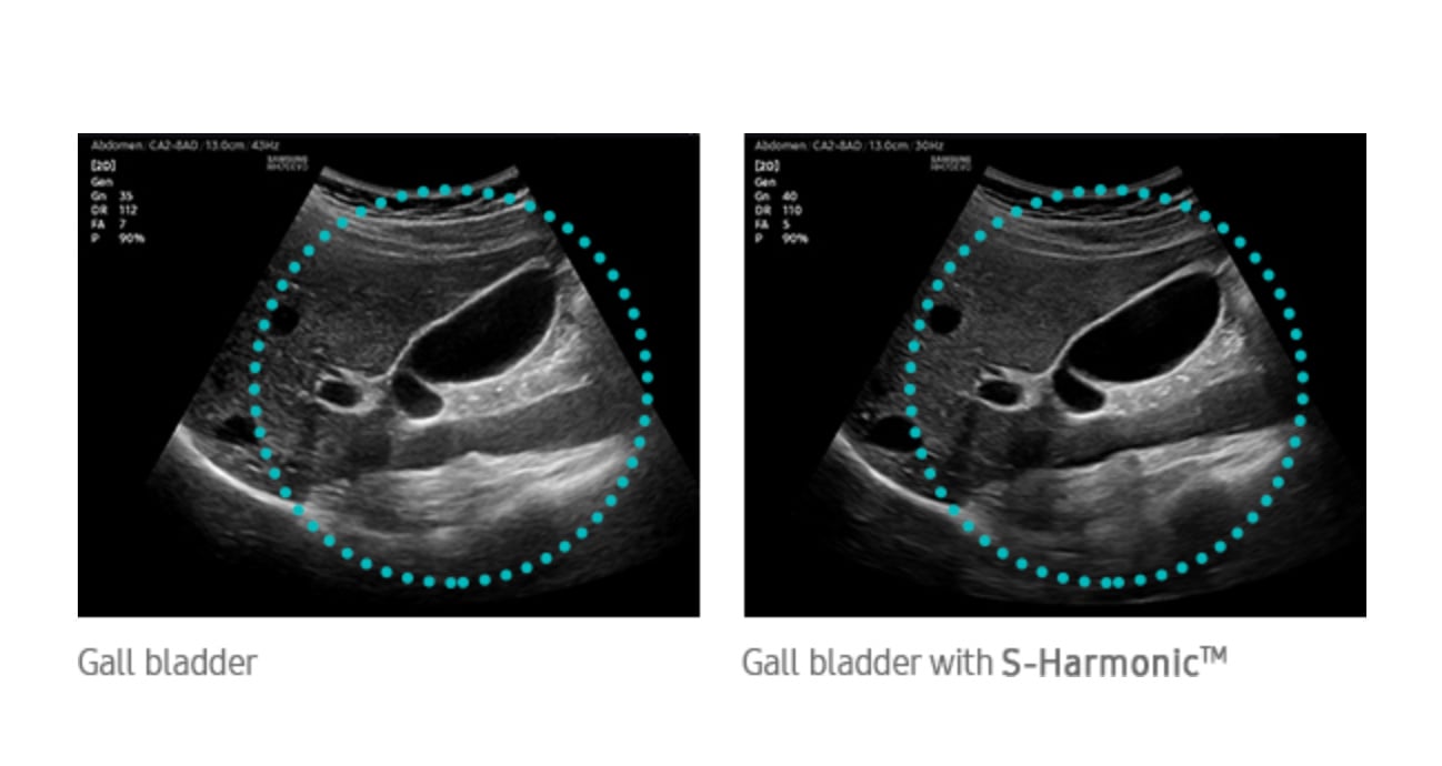 samsung-hm70-uniform-imaging