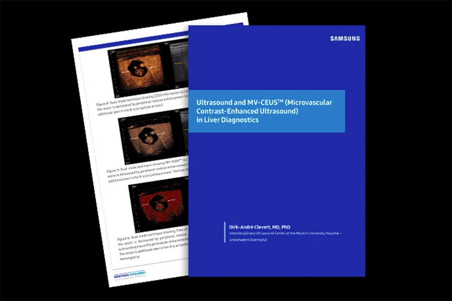 samsung-mv-ceus-ultrasound-inset