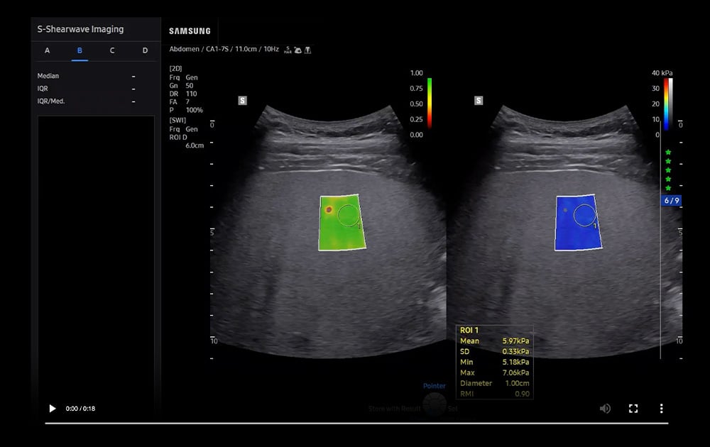 samsung-r20-EzSWI-thumbnail