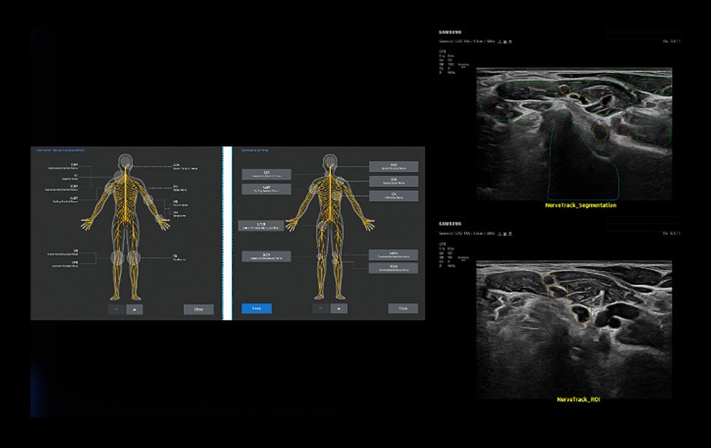 samsung-r20-Nervetrack