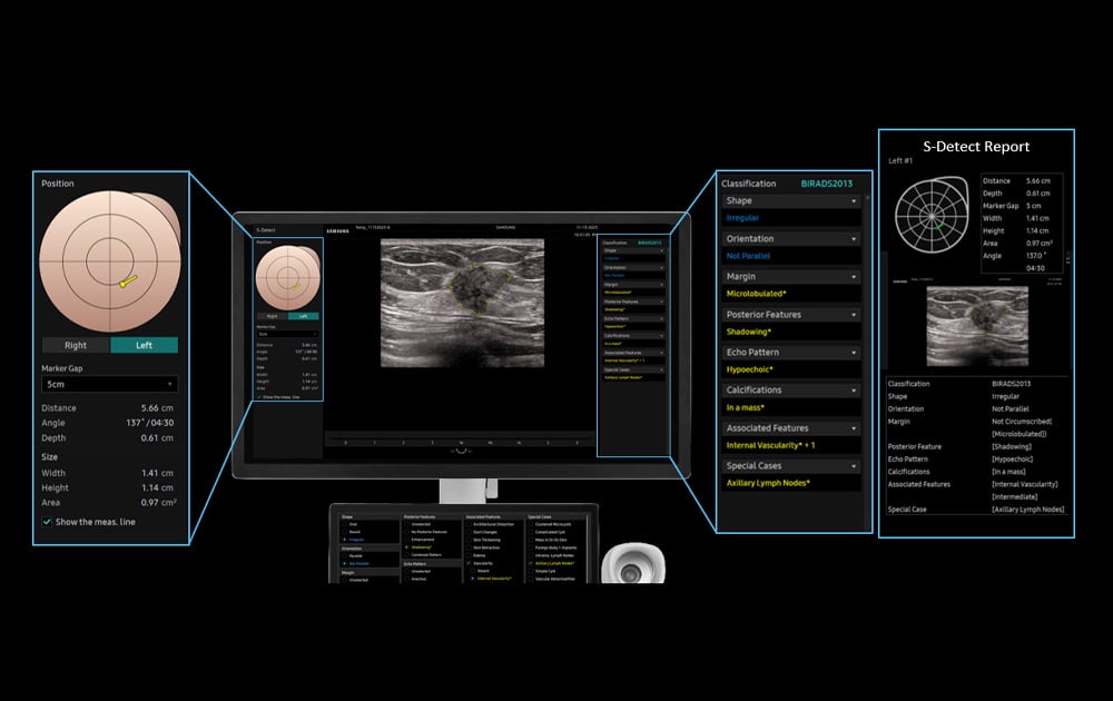 Ultrasound | General Imaging | R20 | Samsung Healthcare
