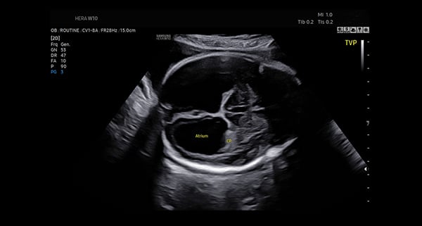 usa-WH-w10-Automated image classification
