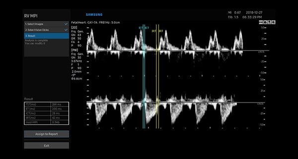usa-WH-w10-Semi-automated Myocardial