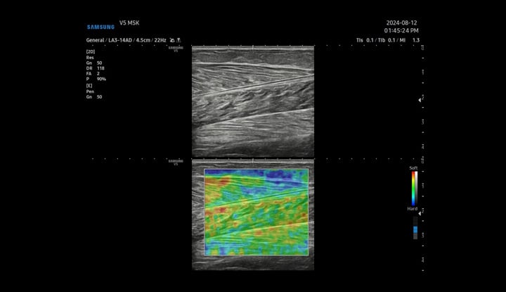 usa-samsung-gi-v5-elastoscan