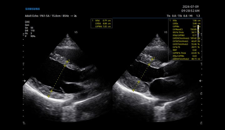 usa-samsung-gi-v5-heart-assist
