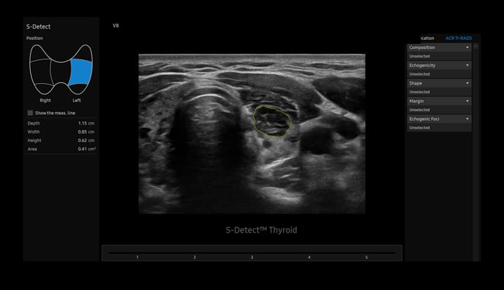 usa-samsung-gi-v8-auto-s-detect-thyroid