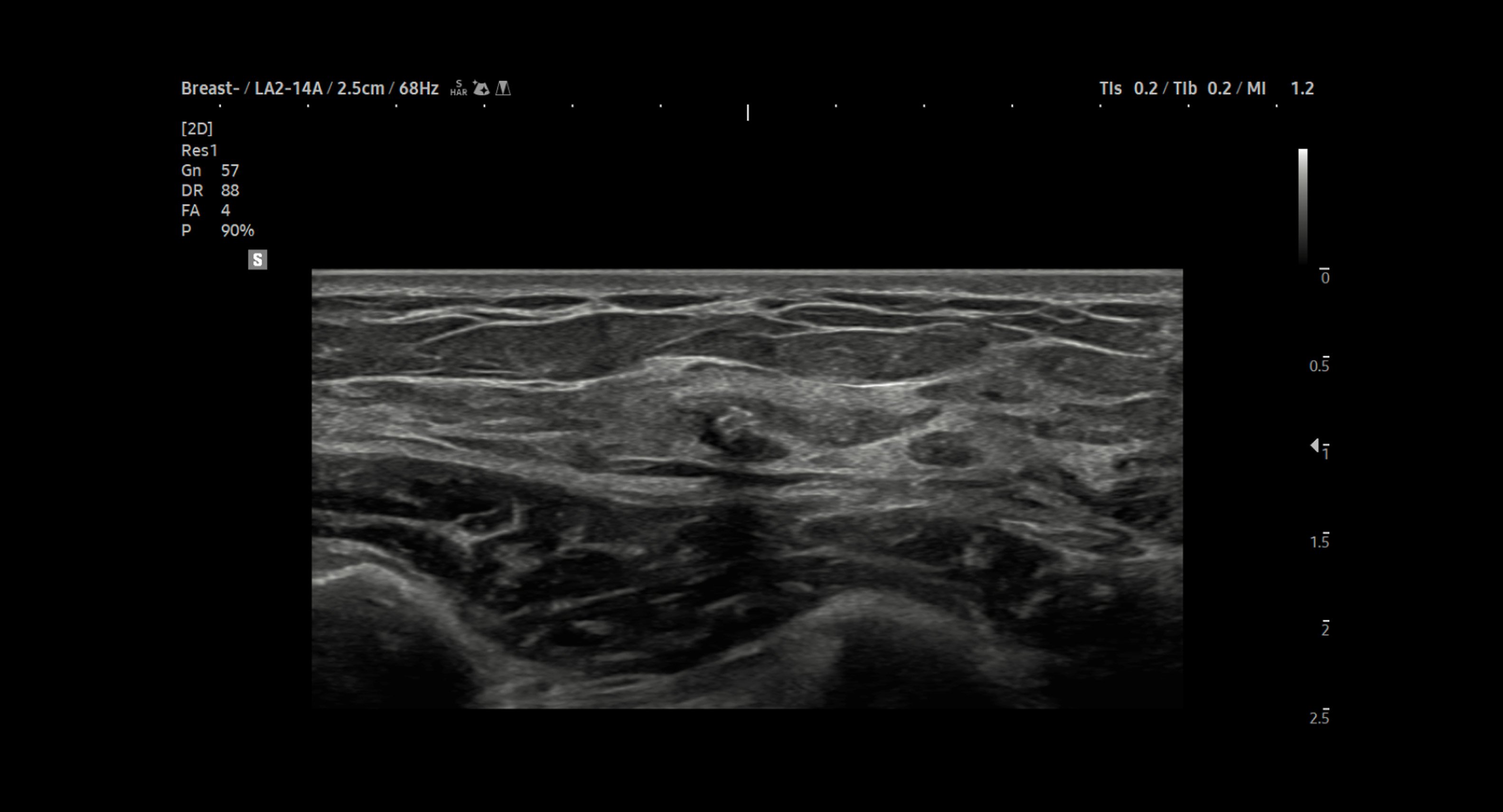 usa-samsung-gi-v8-breast-2d