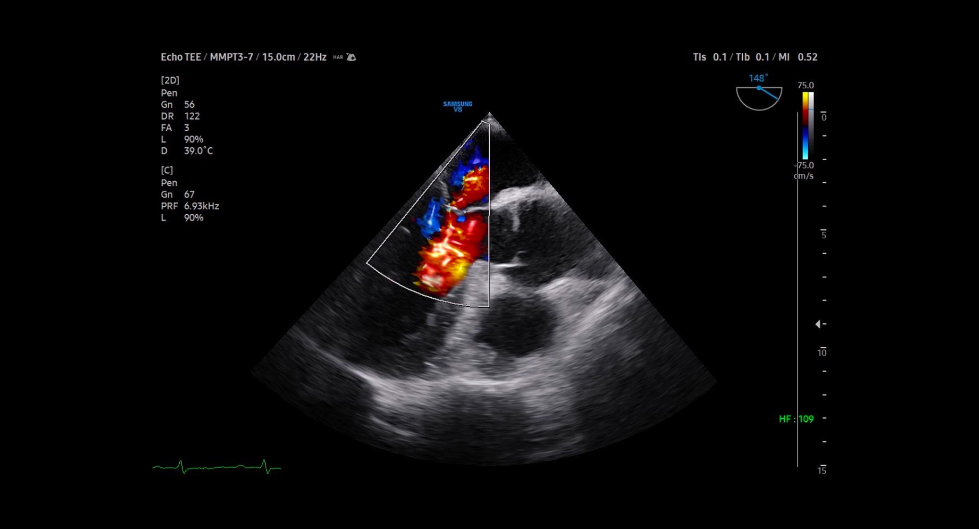 usa-samsung-gi-v8-cardiac-lumi