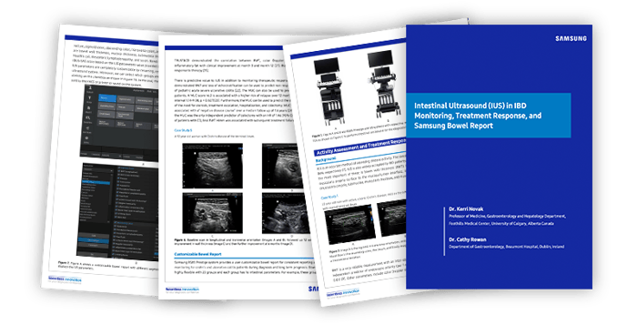 usa-samsung-poc-intestinal-ius-in-ibd-sm