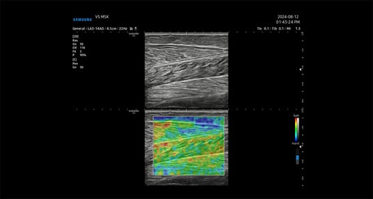 usa-samsung-poc-v5-elastoscan