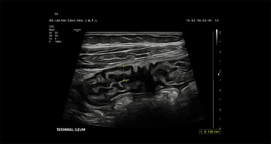 usa-samsung-poc-v8-bowel-3