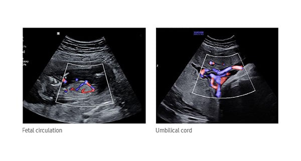 usa-samsung-wh-hm70-fetal-circ