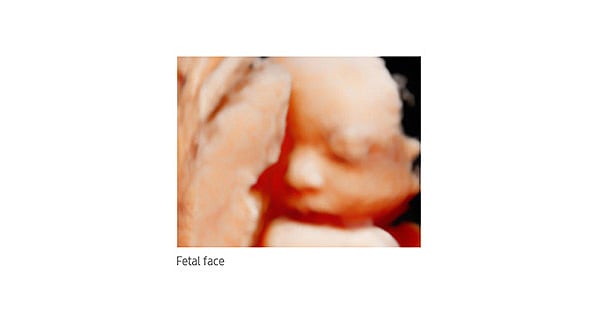 usa-samsung-wh-hm70-fetal-face