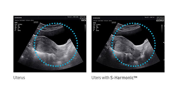 usa-samsung-wh-hm70-fetal-uterus